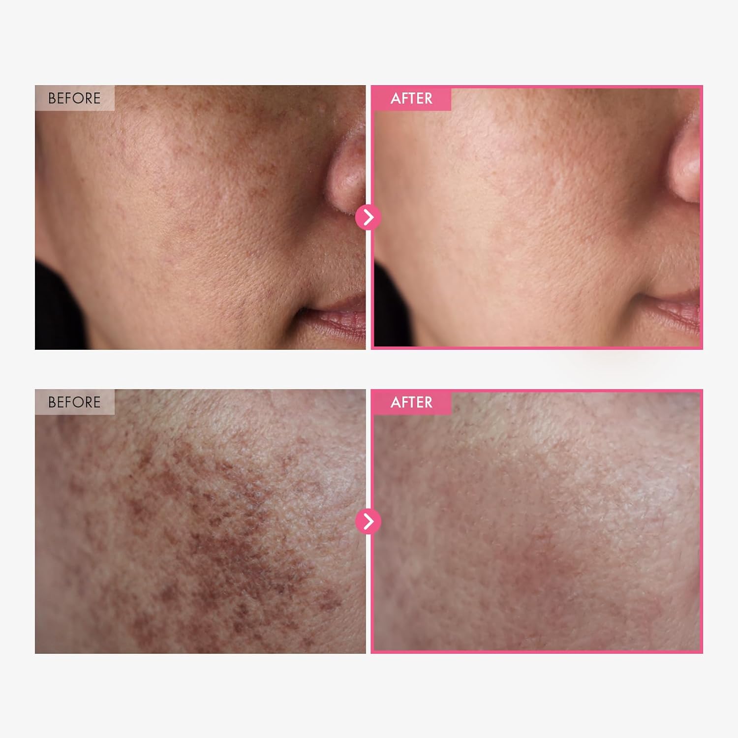 Blue Pinafore Denim Dress