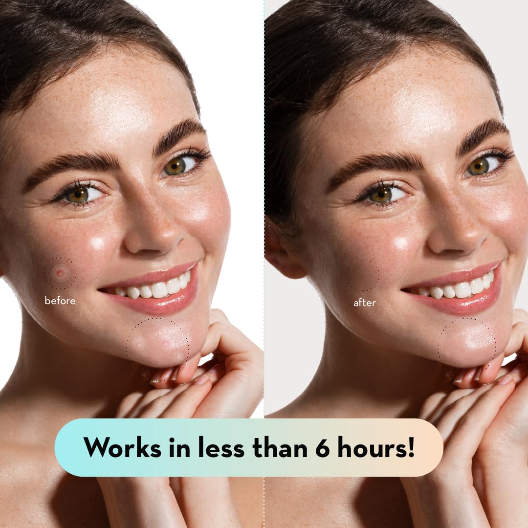 Blue Pinafore Denim Dress