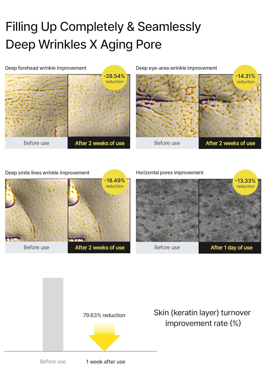 Blue Pinafore Denim Dress