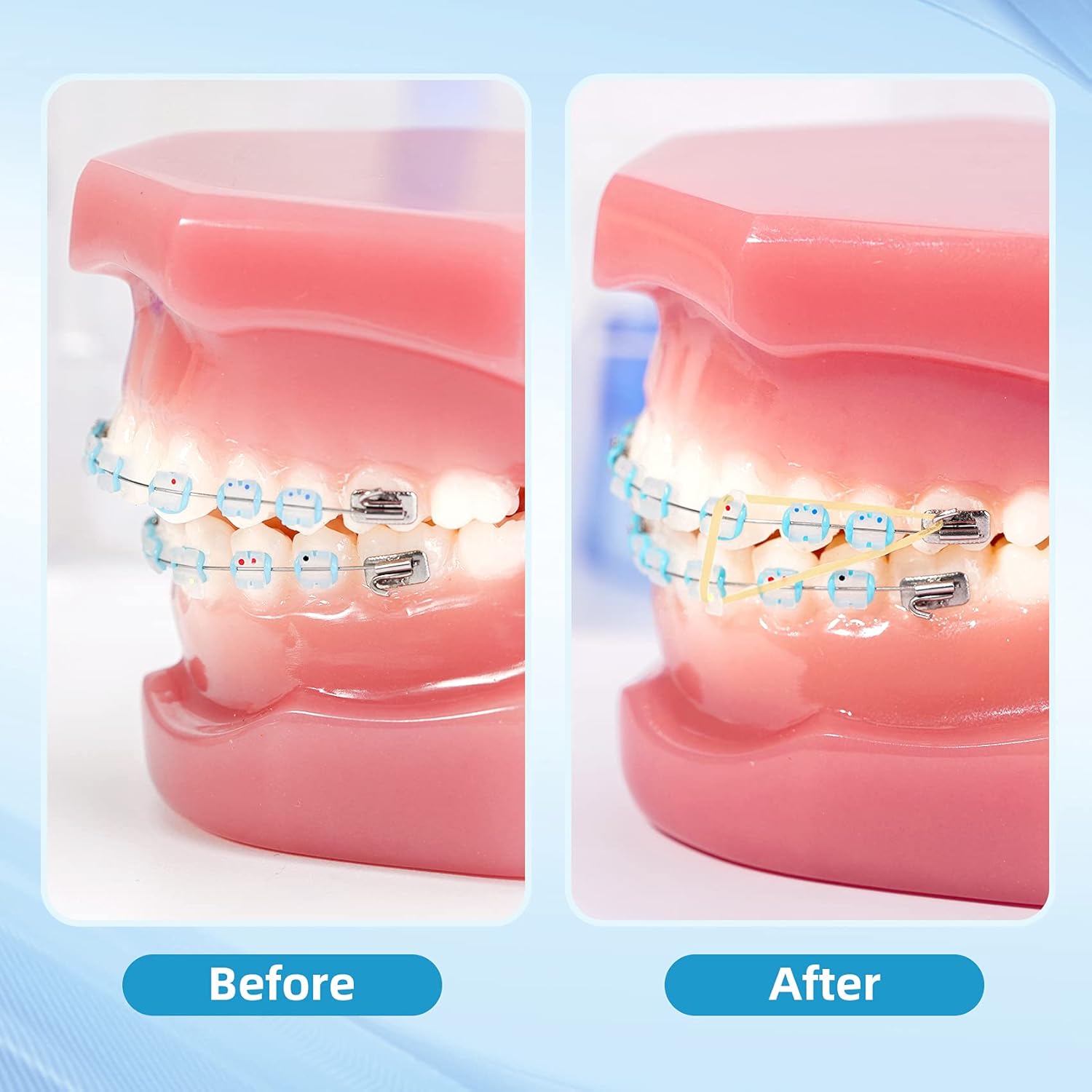 Blue Pinafore Denim Dress