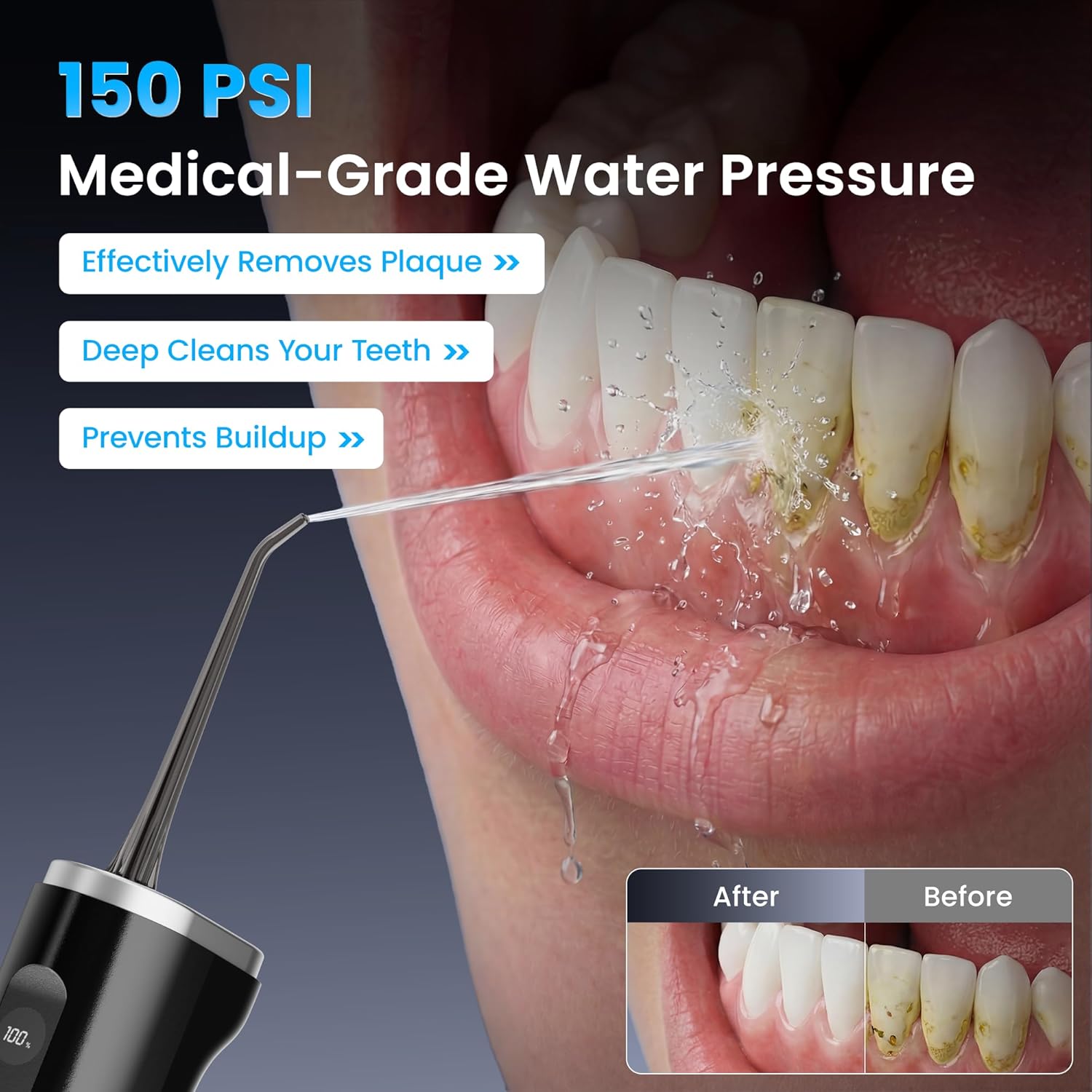 Blue Pinafore Denim Dress